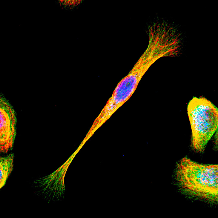 „Cells on the Move"
Photo: Hereon/Yan Nie On the Move_Helmholtz Imaging