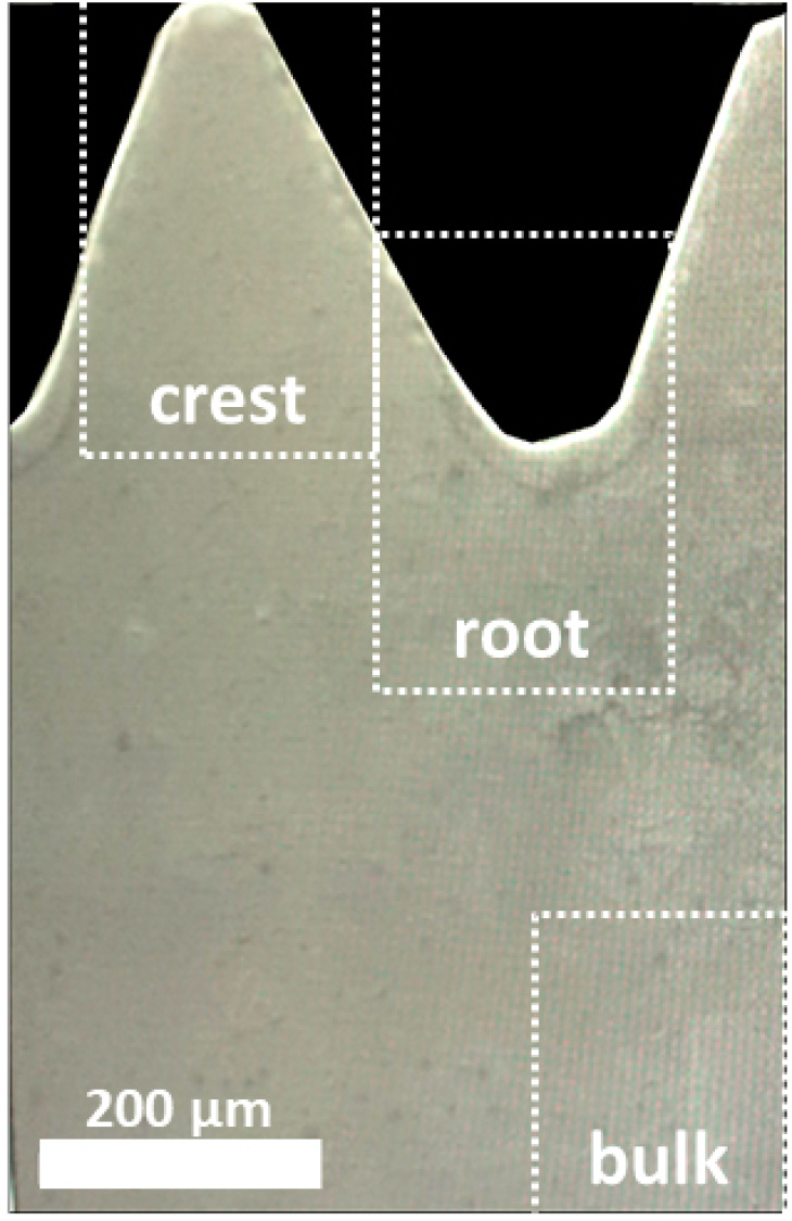 By using a special microscope image you can see areas of crests and roots on a Mg-5Gd screw. Photo: Krüger et. al 2021 Microscope image