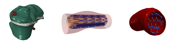 Examples of our digital twins: Left: Fenite elements (FE) model of a sheep bone with magnesium screw (red) through the growth plate (white). Centre & right: Stent with expansion balloon in an artery at different stages. Digitale Zwillinge 3