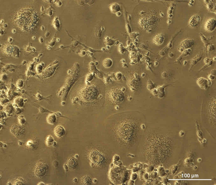 Differenzierte Osteoblasten (kleine Zellen) fördern die Aktivität von Osteoklasten (runde, größere Zellen) in der Kokultur © Steven Behr