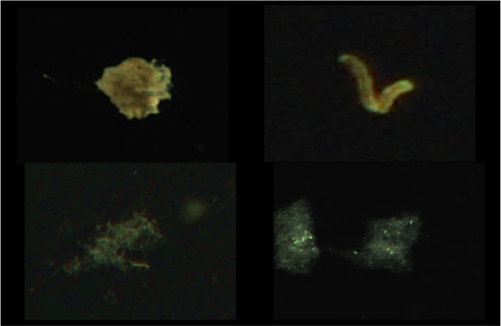 Example images of different marine snow aggregates. <i>-Image: Klas Ove Möller/Hereon-</i> Marine Snow
