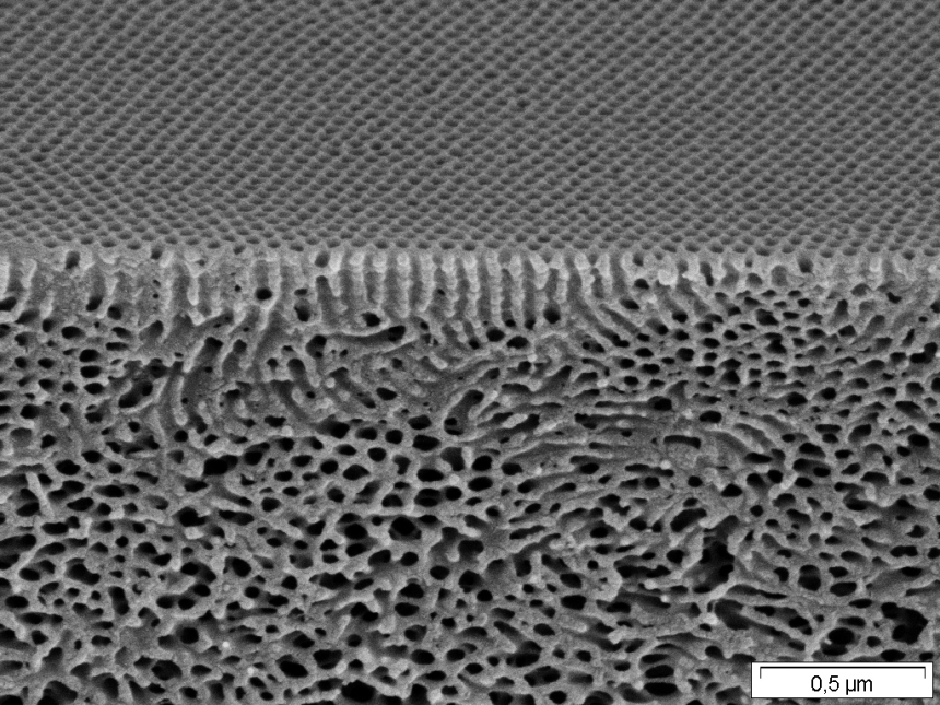 Selbstorganisierende isoporöse Blockcopolymer-Membran